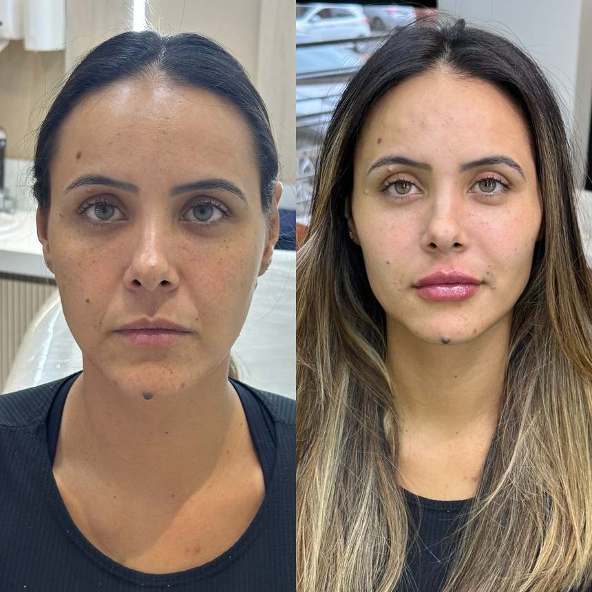Depois do tratamento — caso 1