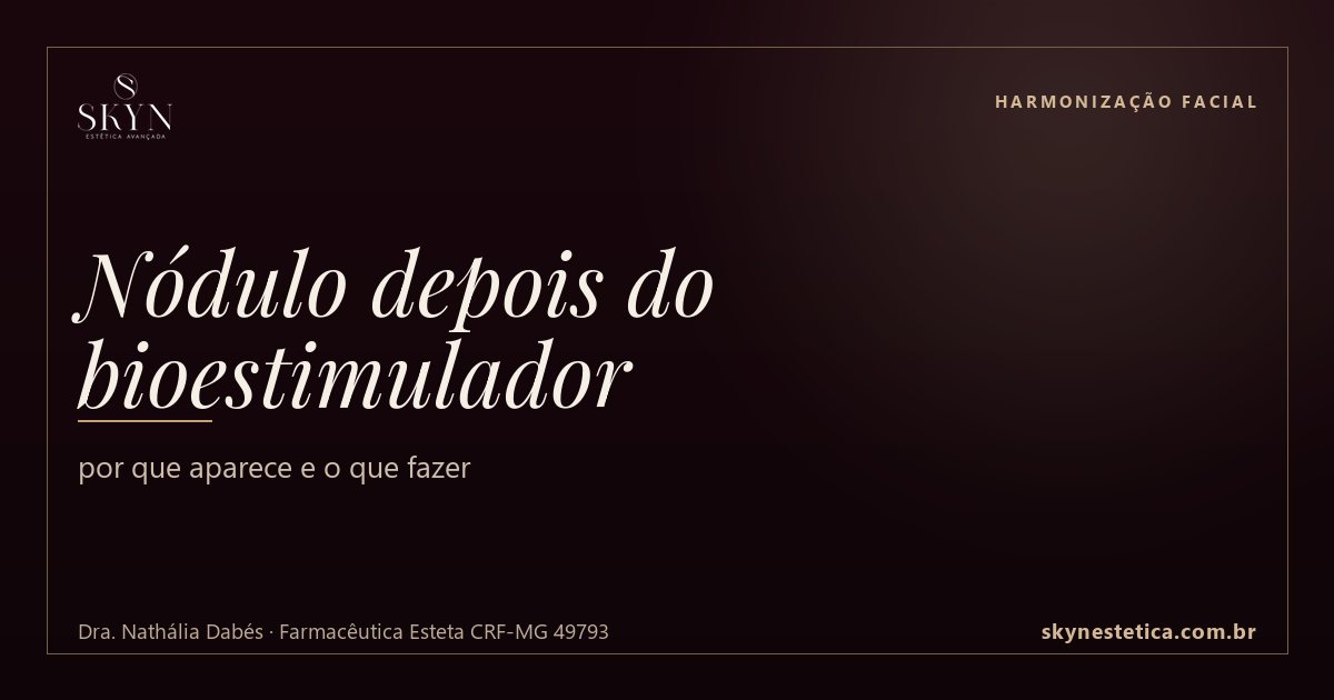Nódulo depois do bioestimulador: por que aparece e o que fazer